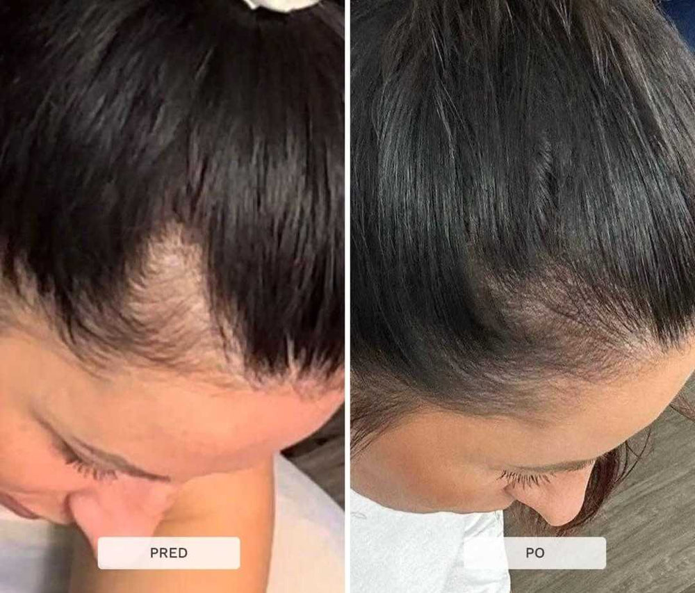 Multi-aktívne sérum scalp (na rast vlasov)
