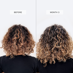 Vegánske vitamíny na rast vlasov 3 mesačná zásoba