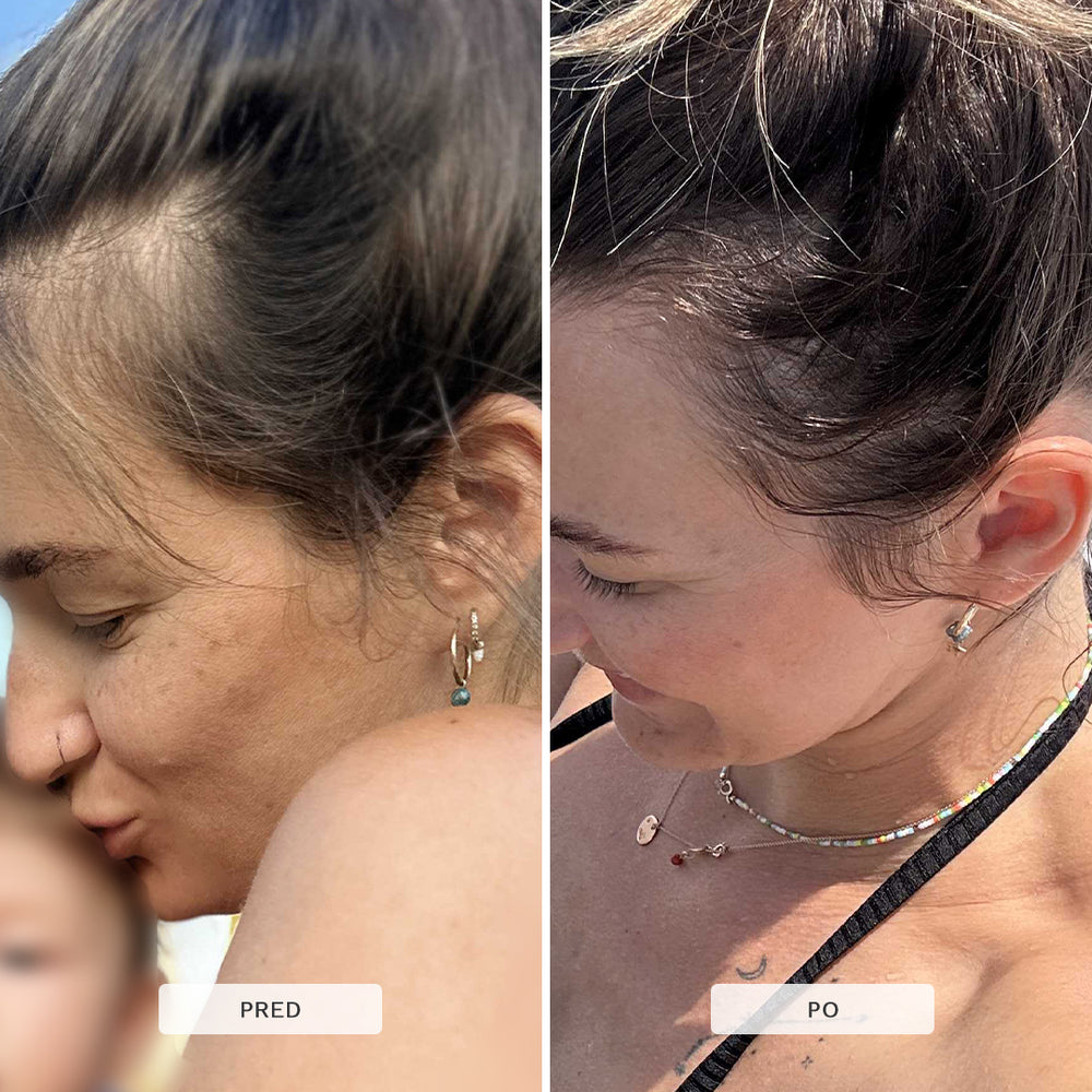 Multi-aktívne sérum scalp (na rast vlasov)