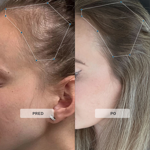 Trio na rast vlasov v tehotenstve